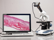 AmScope M620A-DK-5MBI M620 Series Darkfield Monocular Compound Microscope 40X-1600X Magnification w/ LED, 5.3MP Back-Lit USB 2.0 Camera and 3D Mechanical Stage (7)