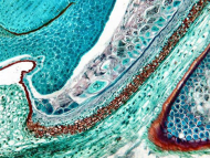 AmScope B660C 40X-2500X Professional Binocular Compound Microscope w Kohler Illumination (7)